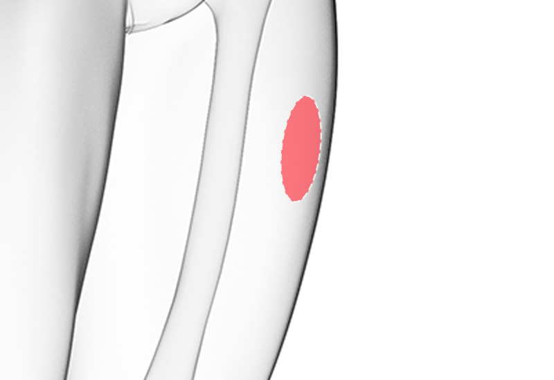 필러 & 자가지방