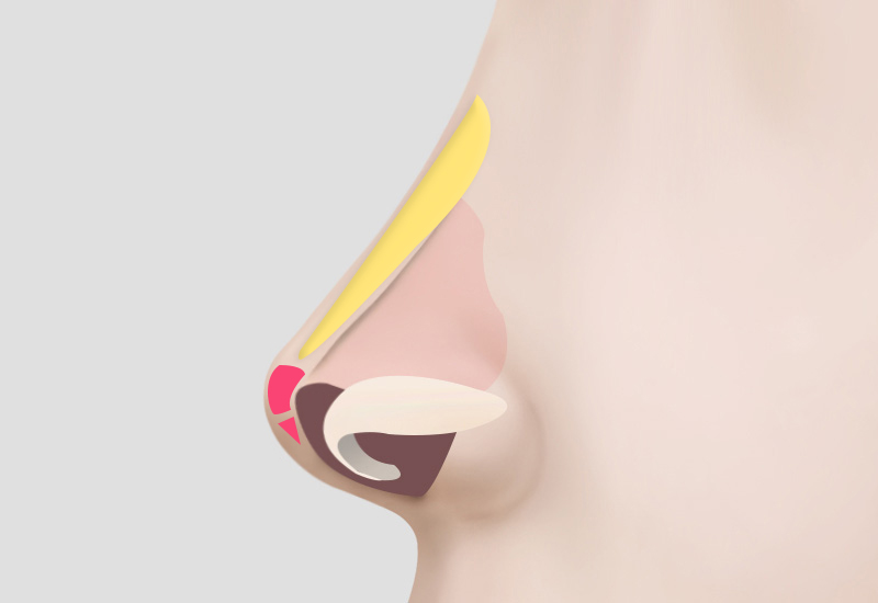 봉합 및 모양 교정