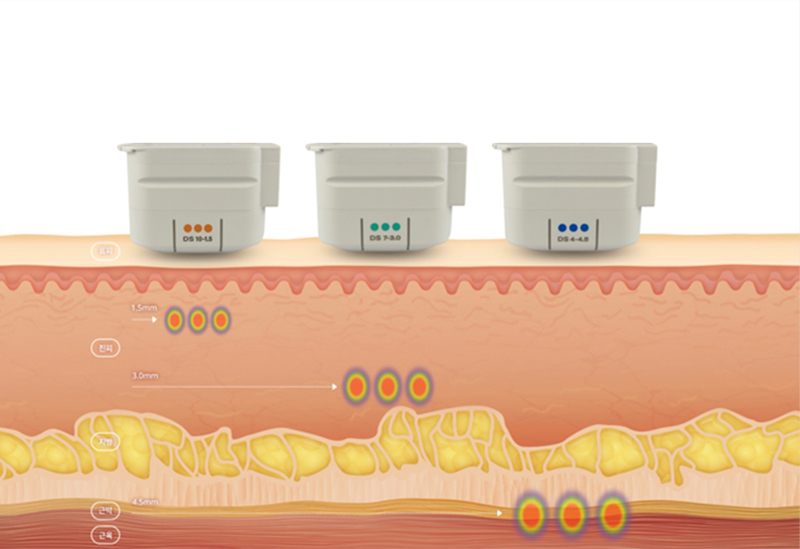 맞춤 깊이 설계